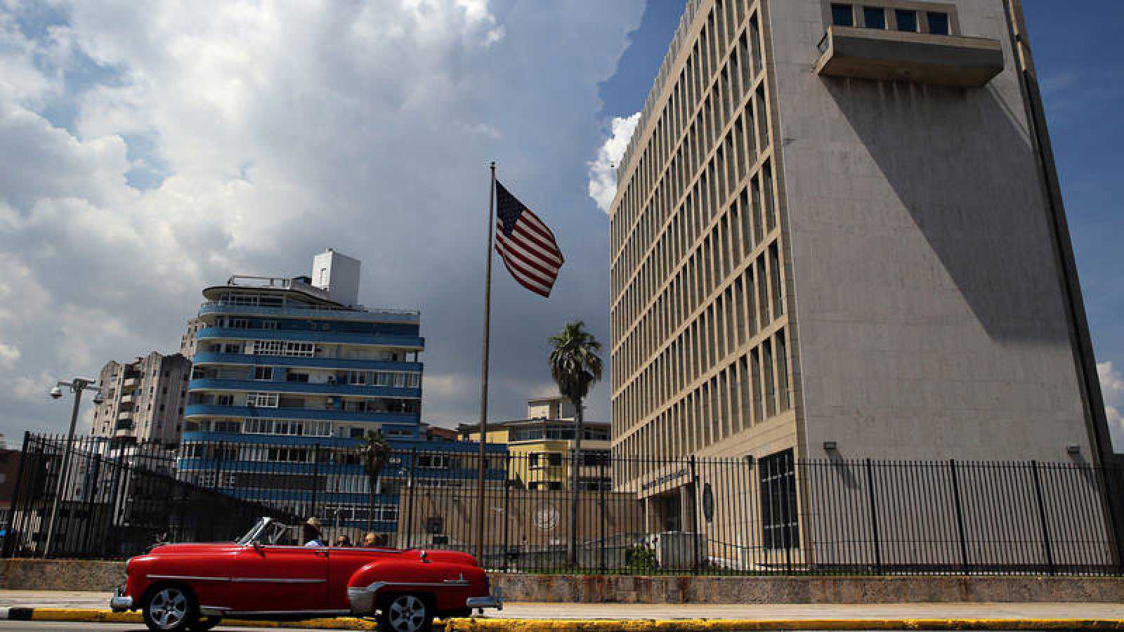 Embajada Cuba EEUU ataque acústico